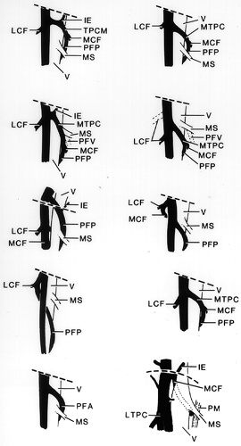 Image of femoral artery and its branches