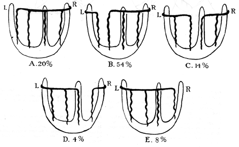 Image of distribution of coronary arteries on back of ventricles