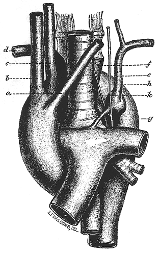Image of specimen of right aortic arch