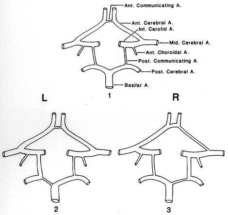 Circle Of Willis Usual And Unusual Circle Of Willis Usual And Unusual