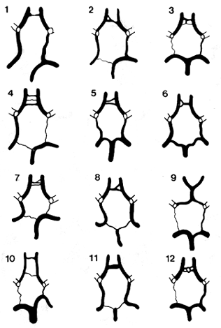 Image Of Variable Circle Of Willis Image Of Variable Circle Of Willis