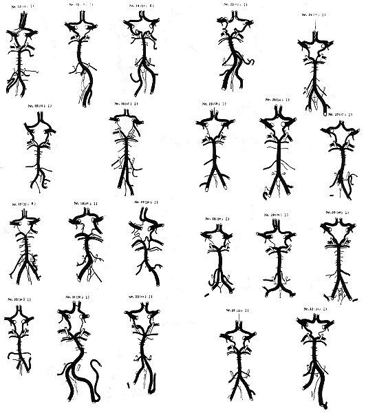 Image of variations in circle of Willis