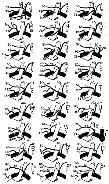 Image of thyrocervical trunk, rarer variations