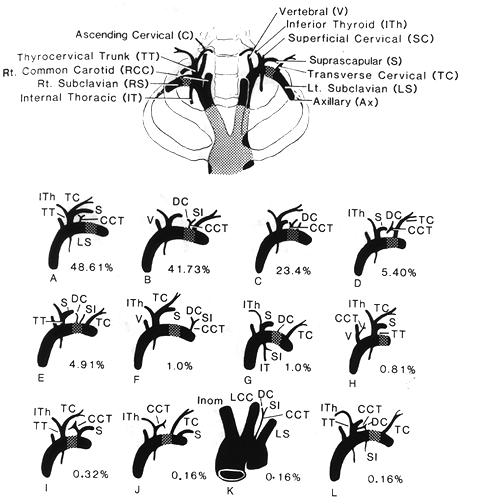 Image of costocervical trunk