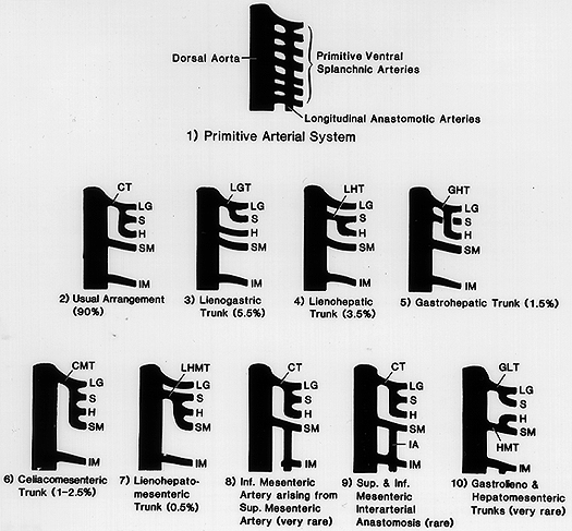 Image of variations in unpaired abdominal arteries