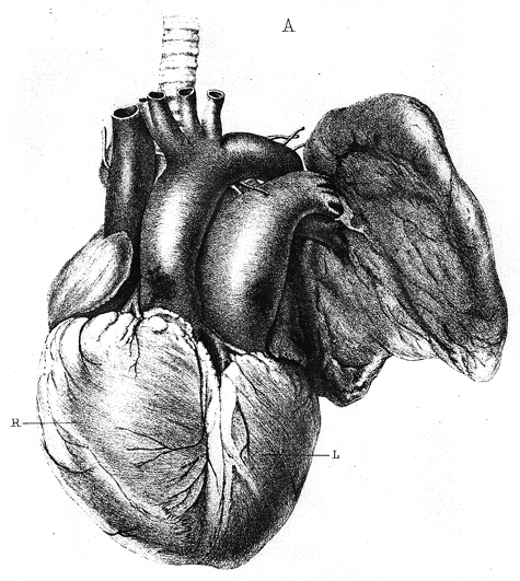 Image of transposition of great vessels