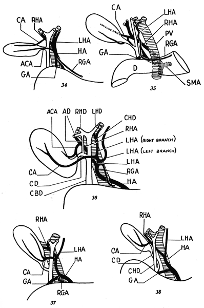 Image of hepatic pedicle