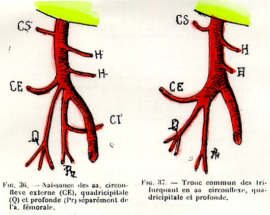Image of femoral artery and branches