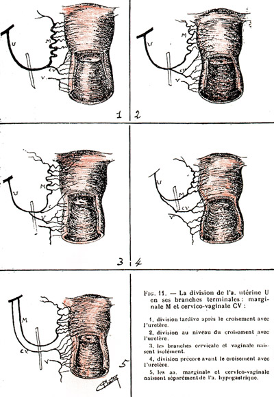 Image of varieties ofthe uterine artery