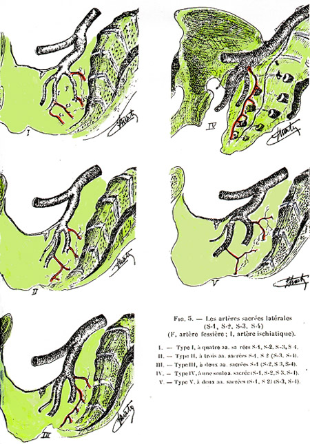 Image of lateral sacral arteries