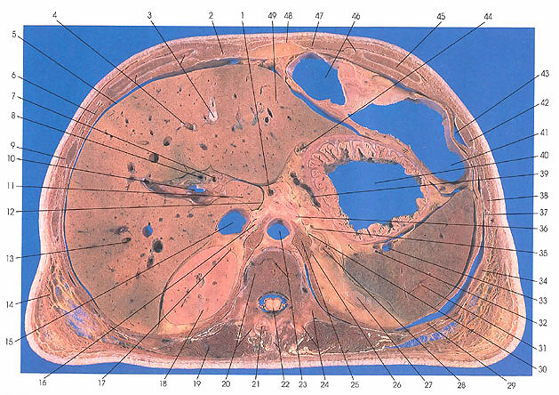 Plate 5.6