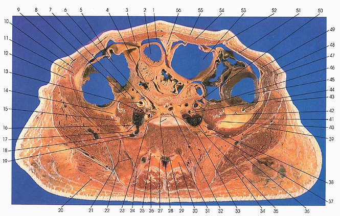 sacral spinal cross section