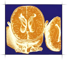 Atlas of Human Anatomy in Cross Section