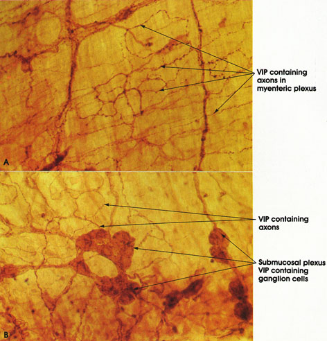 Plate 6.111 Vasoactive Intestinal Polypeptide (VIP)