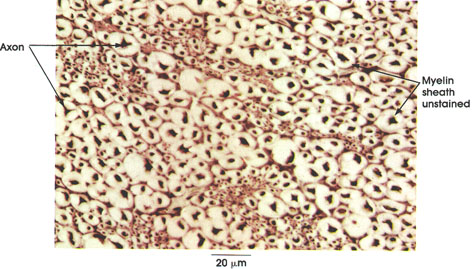 Plate 6.113 Nerve Fibers