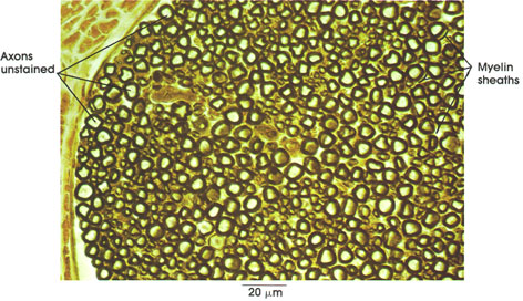 Plate 6.115 Peripheral Nerve