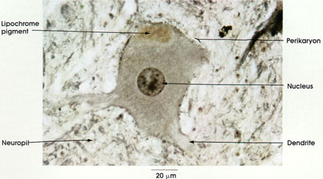 Plate 1.13: Lipochrome Pigment