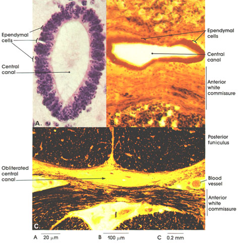 Plate 6.131 Ependyma: Spinal Cord