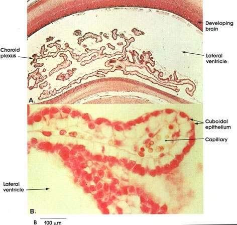 Plate 6.132 Choroid Plexus