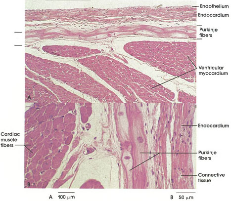 Plate 8.151 Purkinje Fibers