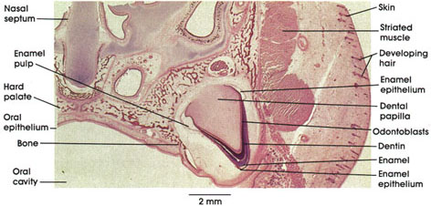 Plate 10.184 Developing Tooth