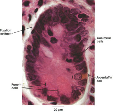 Plate 10.197 Duodenum