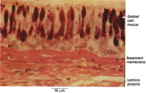 Plate 11.223 Ciliated Pseudostratified Columnar Epithelium