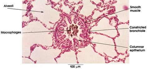 Plate 11.226 Bronchiole