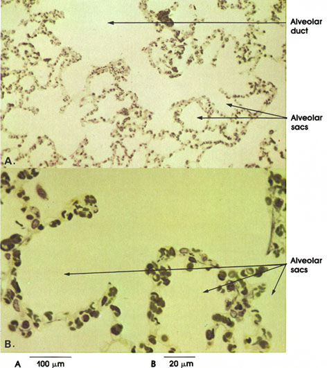 Plate 11.229 Alviolar Duct and Alveolar Sacs