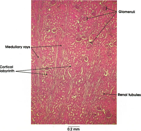 ultrasound pictures of kidneys and bladder