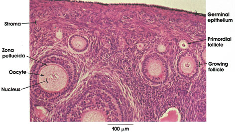 Plate 13.246 Ovary