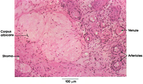 Plate 13.251 Ovary