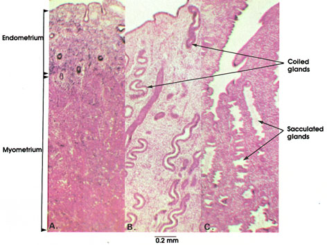 Plate 13.252 Uterus