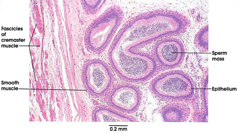 Plate 14.270 Epididymis