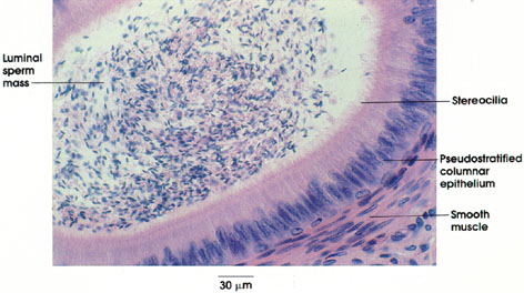 Plate 14.271 Epididymis