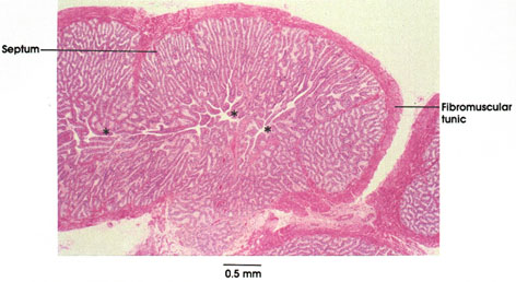 Plate 14.273 Seminal Vesicle