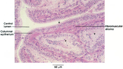 Plate 14.275 Seminal Vesicle