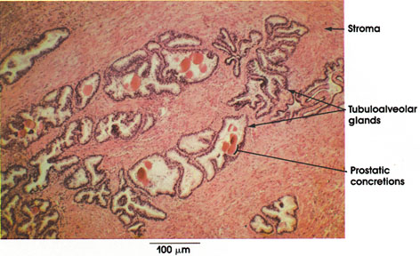 Plate 14.276 Prostate Gland