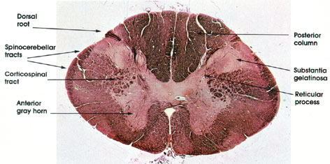 Plate 17.317 Spinal Cord