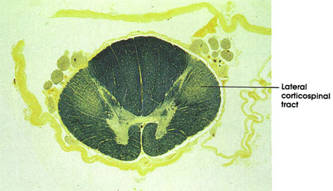 Plate 17.320 Spinal Cord