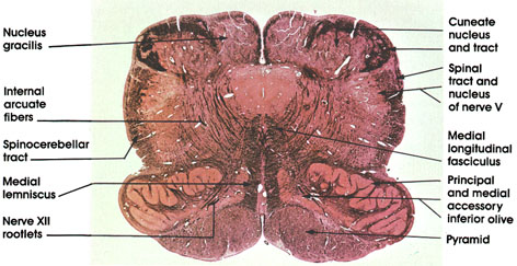 Plate 17.330 Medulla Oblongata