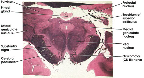 Plate 17.341 Mesencephalon-Diencephalon Junction