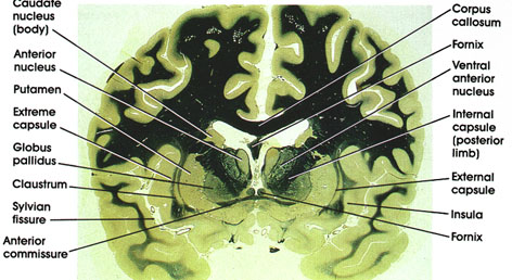 Plate 17.344 Diencephalon