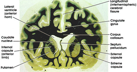 Plate 17.347 Basal Ganglia