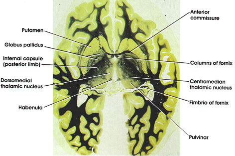 Plate 17.355 Anterior Commissure