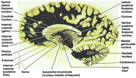 Plate 17.361 Corpus Striatum and Medial Geniculate Nucleus