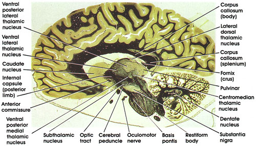 Plate 17.363 Section through Centromedian Thalamic Nucleus