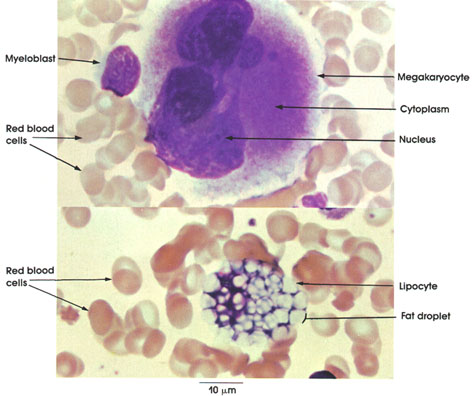 Plate 4.62: Bone Marrow