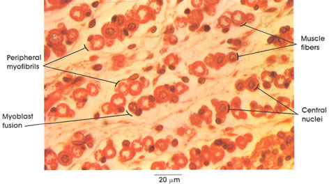 Plate 5.63: Striated Muscle