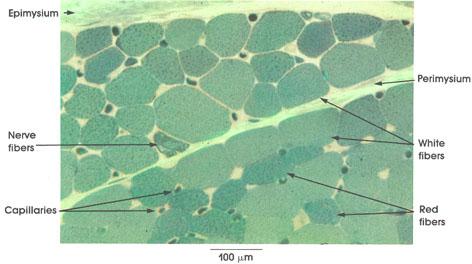 skeletal muscle cross section labeled